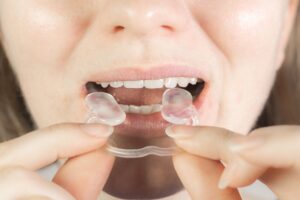 Patient receiving TMD treatment at a dental clinic in Little Rock.